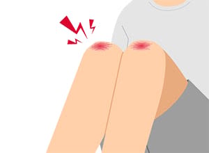 band-aid_top_trouble_surikizu