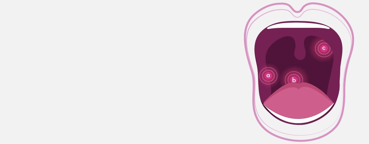 types-of-sore-throat-mouth-banner-en-ph