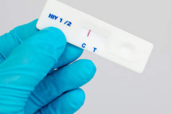 Home Kit Hiv Test