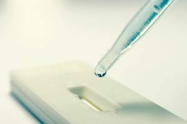 price of hiv test kit