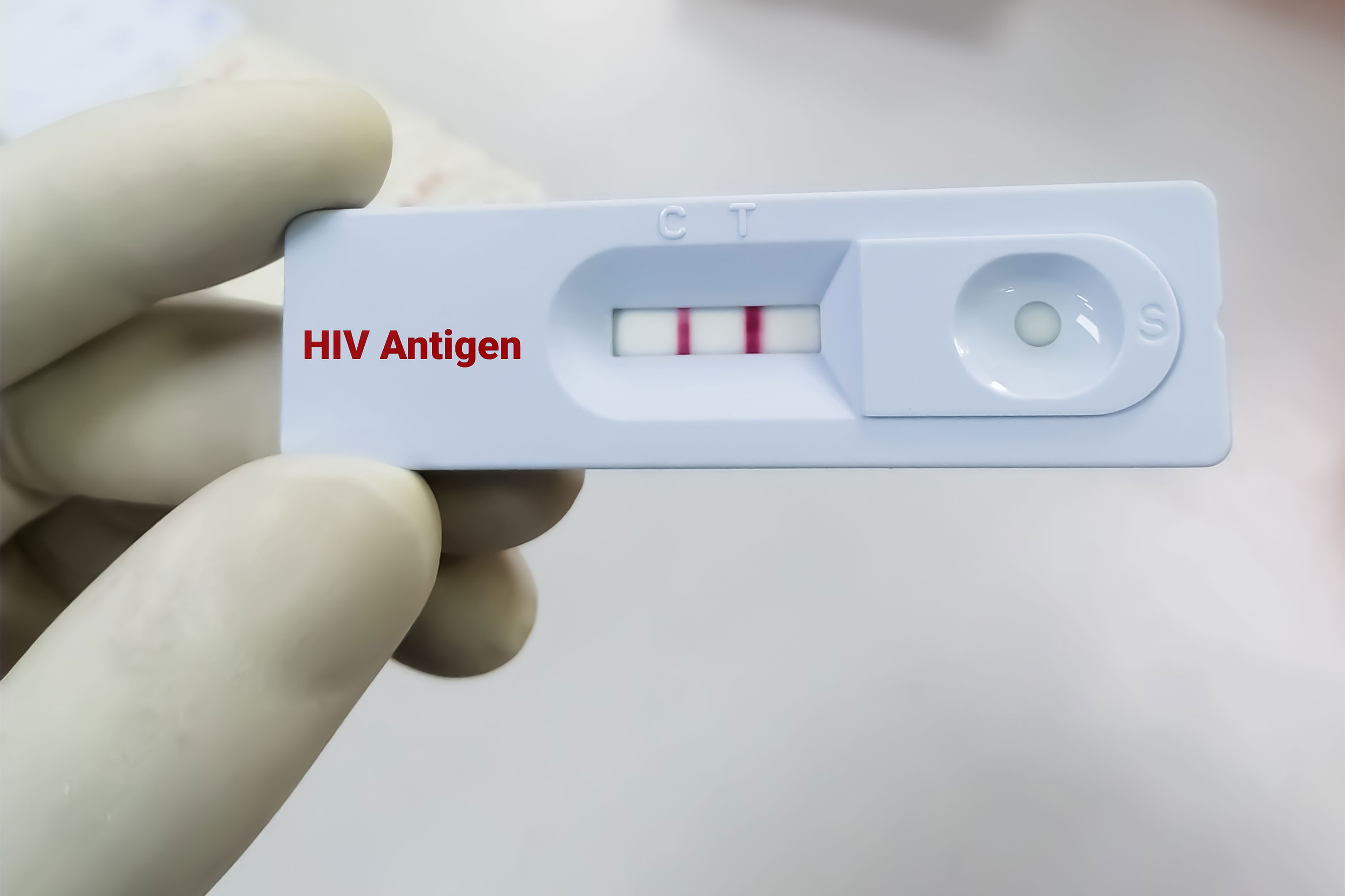 HIV Test Accuracy: Which Type of Test Is Best?