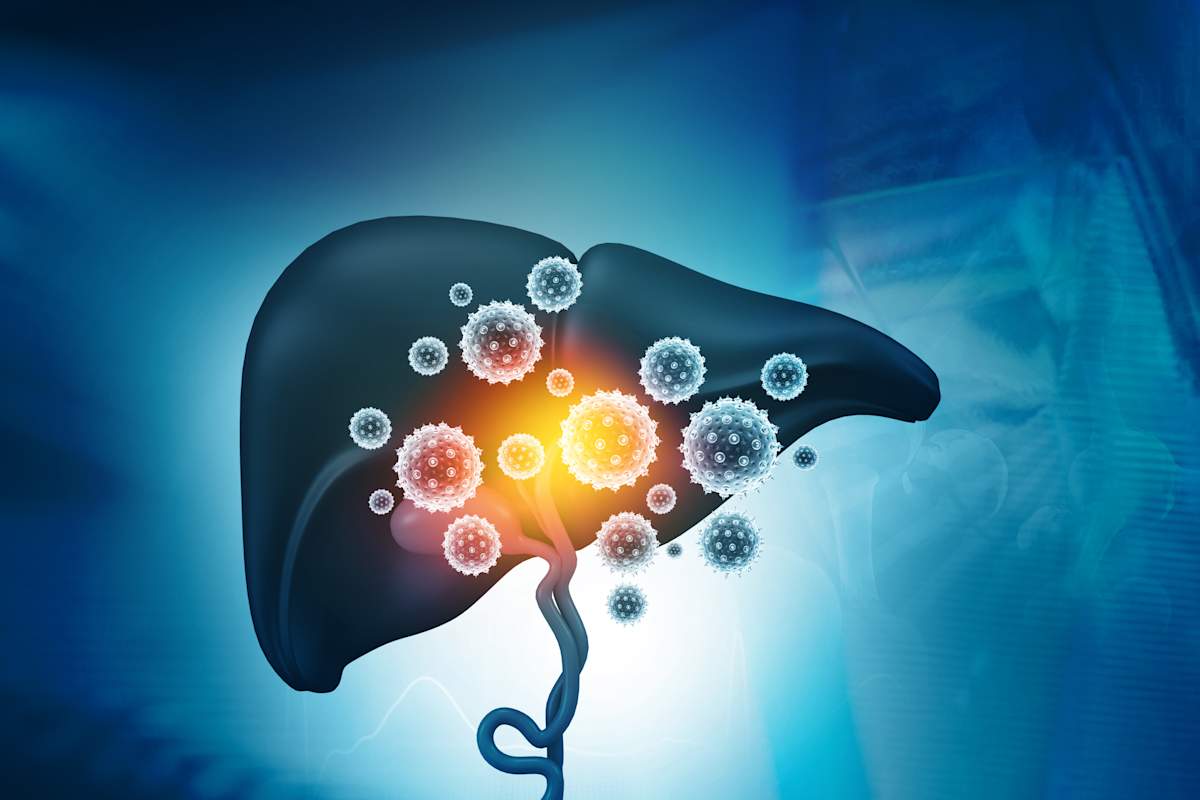 The ABCs of Viral Hepatitis The ABCs of Viral Hepatitis