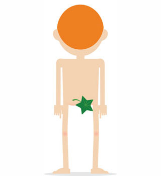 colol rectal cancer and hiv colol rectal cancer and hiv