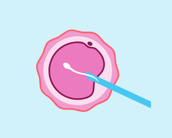 IVF Optional Extras