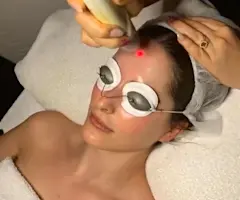 What Is Laser Genesis? The All-Rounder Skin Treatment Dermal Therapists Are Obsessed With