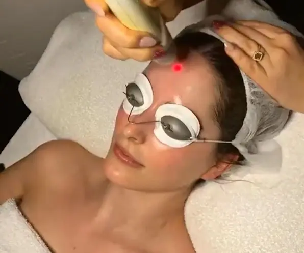 What Is Laser Genesis? The All-Rounder Skin Treatment Dermal Therapists Are Obsessed With