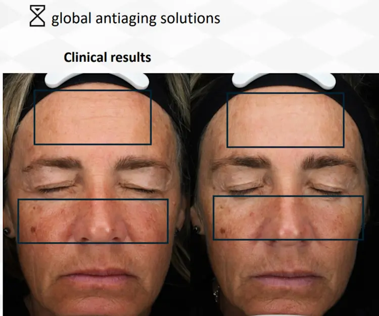 adore beauty article image