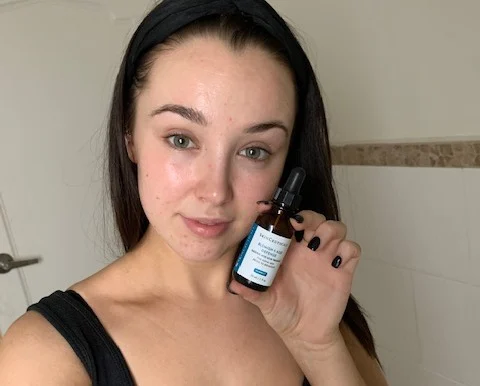 A Makeup Artists Night Skincare Routine for Treating Hormonal Acne
