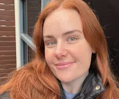 I Turned 30: What I Learnt From My First Anti-Wrinkle Injectables