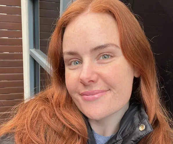 I Turned 30: What I Learnt From My First Anti-Wrinkle Injectables