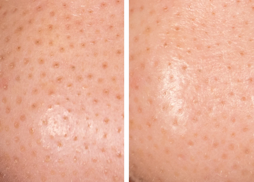 adore beauty article image