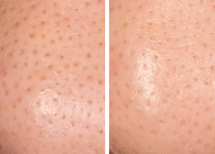 adore beauty article image