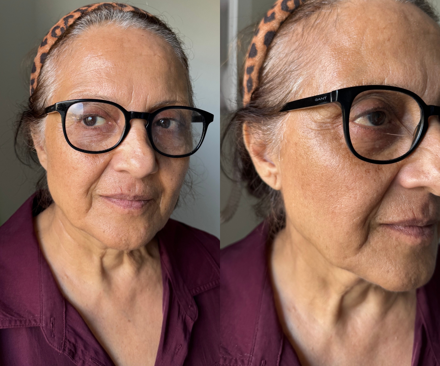 cjc-1295 ipamorelin vs hgh benefits side effects anti aging What is CJC-1295 + Ipamorelin and why is everyone talking about it?  CJC-1295  and Ipamorelin are peptides that work together to naturally stimulate your  body's own growth hormone productionwithout replacing it