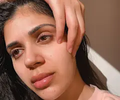 The Vitamin C Serum That Changed My Life and Lifted My Stubborn Pigmentation