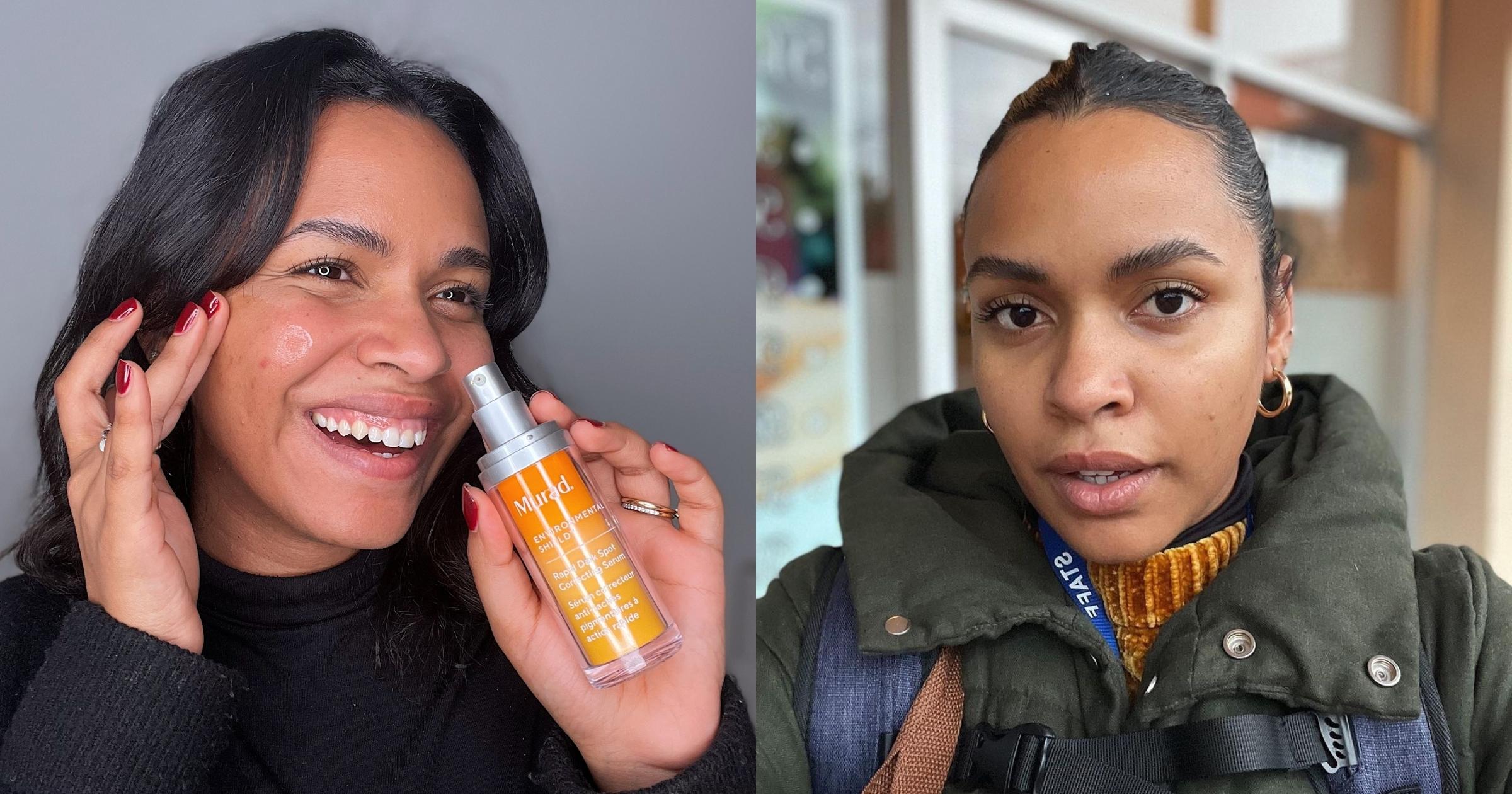 This Serum Faded the Look of My Dark Spots in 2 Weeks & I Have the ...