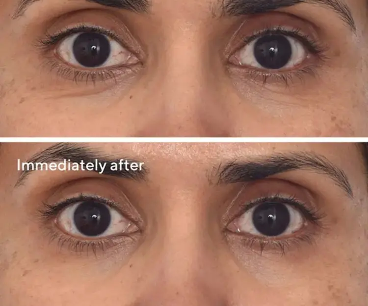adore beauty article image