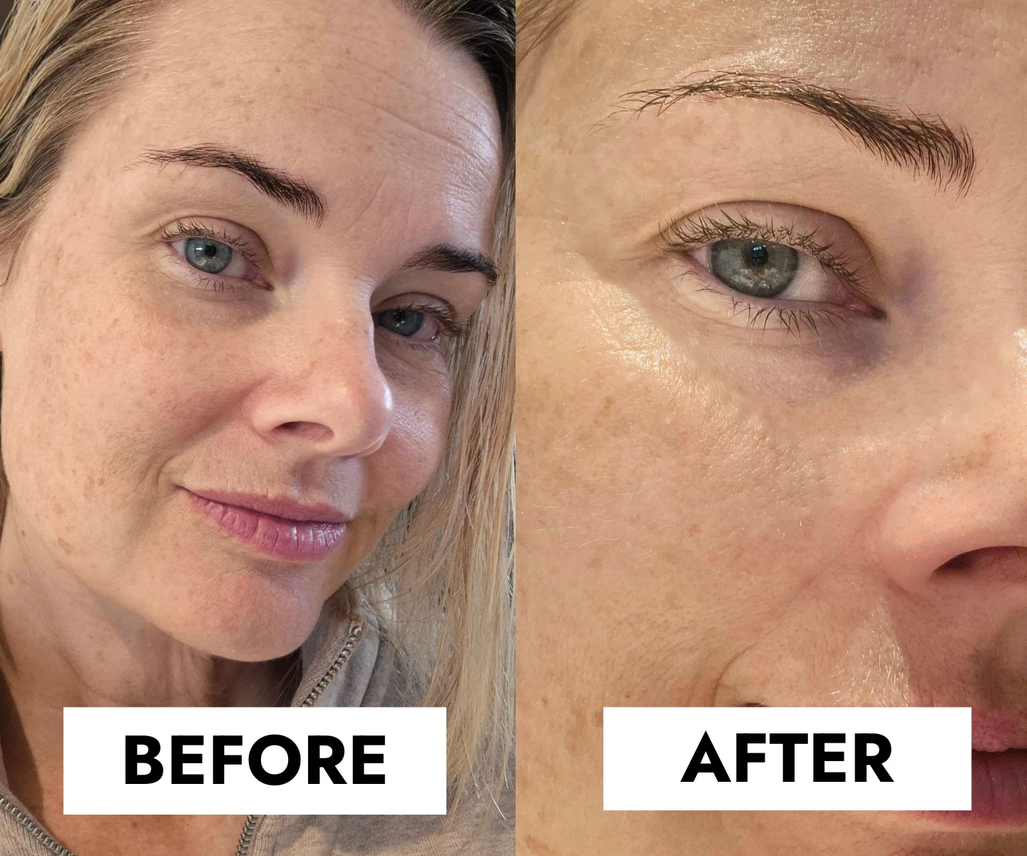 adore beauty article image