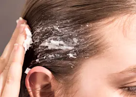 10 Best Dry Scalp Treatments in Australia 2023