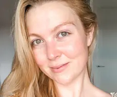 Perioral Dermatitis Skin Care Tips for Calmer, Clearer Skin