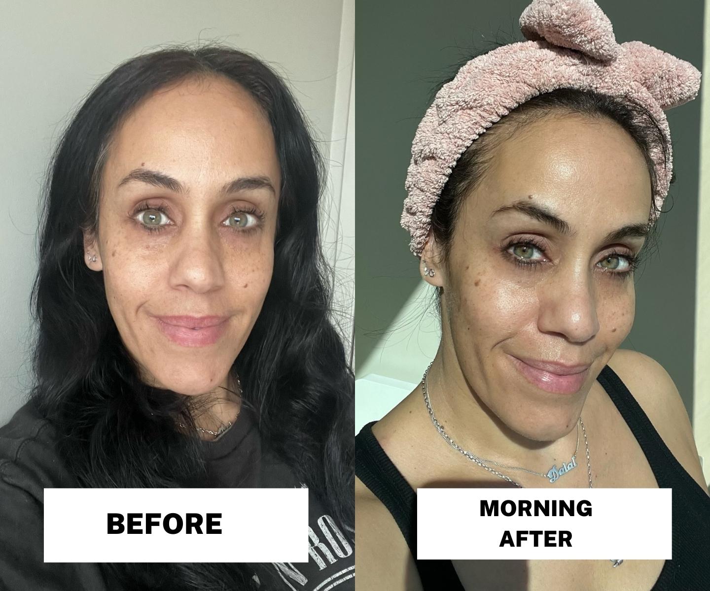 Clarins Beauty Flash Peel before and after pictures