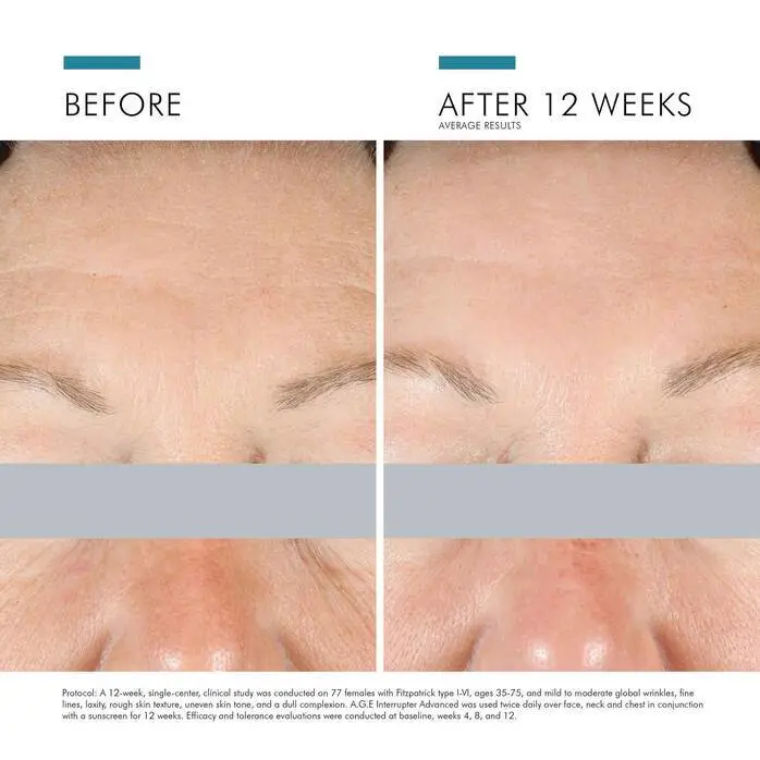 adore beauty article image