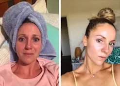 Beauty IQ Article - My Night Routine for Brightening Sun-Damaged, Pigmented Skin