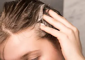 Why Is My Scalp So Oily?