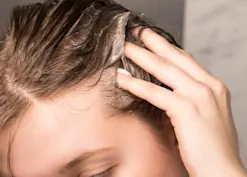 Beauty IQ Article - Why Is My Scalp So Oily?