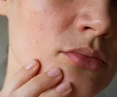 Beauty IQ Article - A Dermal Therapist on What Will (& Won’t) Make Enlarged Pores Look Smaller