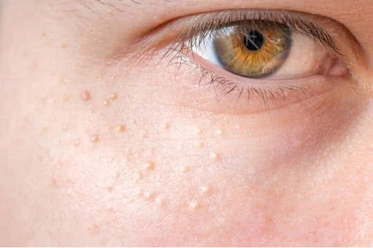 adore beauty article image