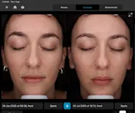  Bridal Skin Prep: Products & Treatments That *Literally* Took a Year Off My Face 