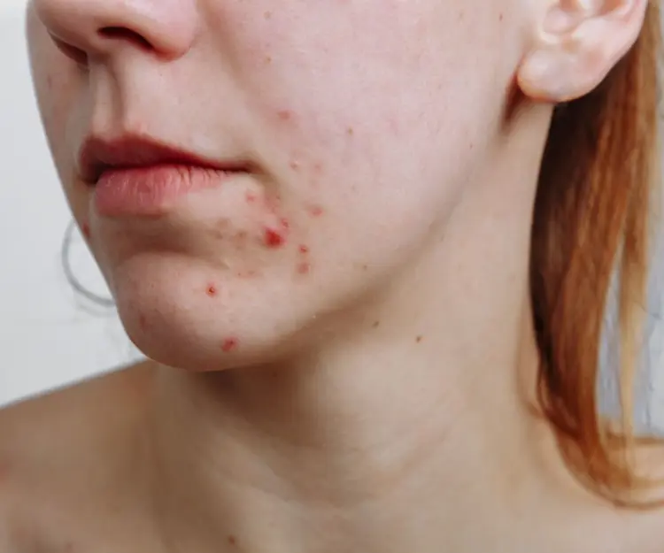 adore beauty article image