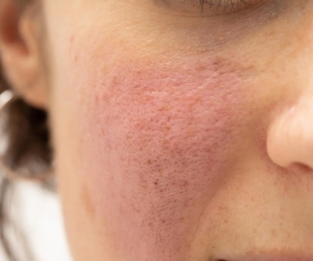 adore beauty article image