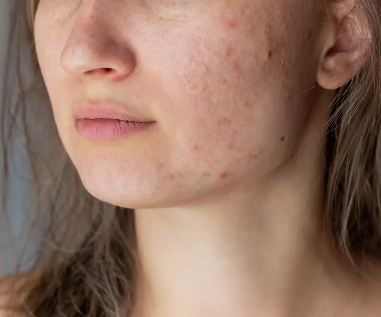 adore beauty article image
