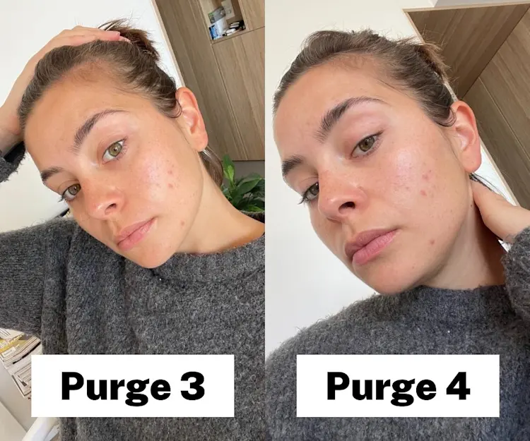 adore beauty article image