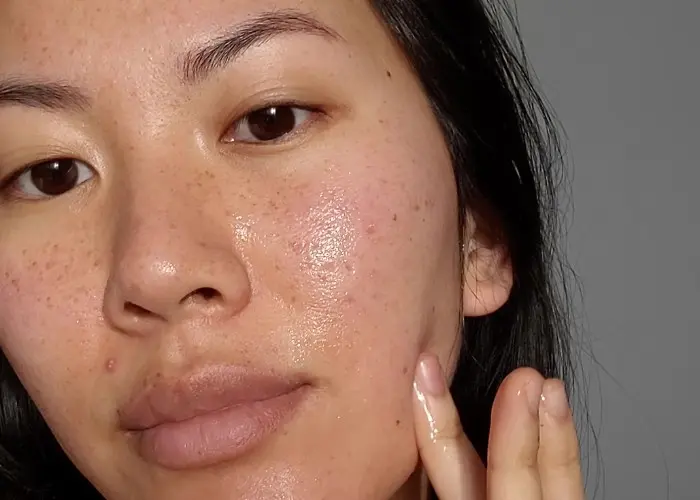The 11 Best Serums for Acne Prone Skin