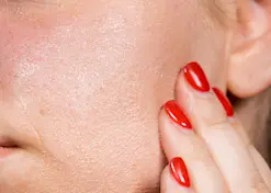 Beauty IQ Article - 6 Best Makeup Removers for Sensitive Skin