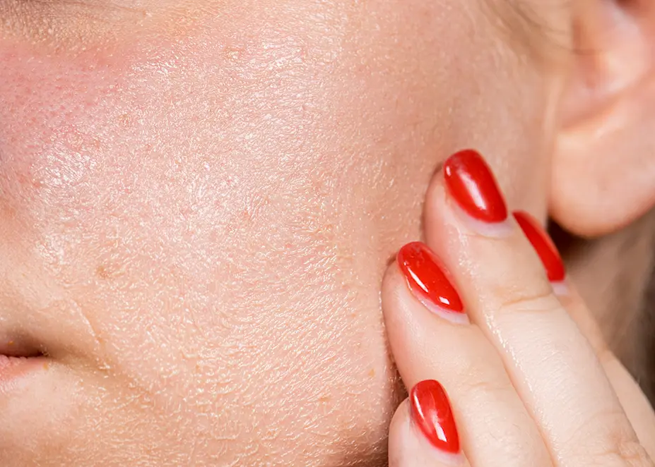 6 Best Makeup Removers for Sensitive Skin