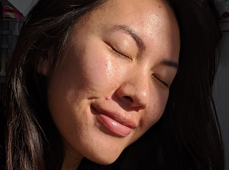 Black Rash Plant The 6 Best Dark Spot Correctors In Australia For 2026