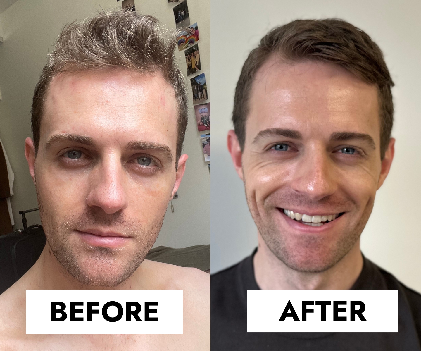 Gerard dewy skin routine before/after in-article