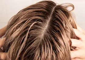 Soothe Irritated Skin with the Best Shampoos for a Sensitive Scalp in Australia