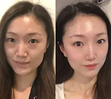 Beauty IQ Article - Keen on K-Beauty? Try this innisfree Skin Care Routine for Combination Skin