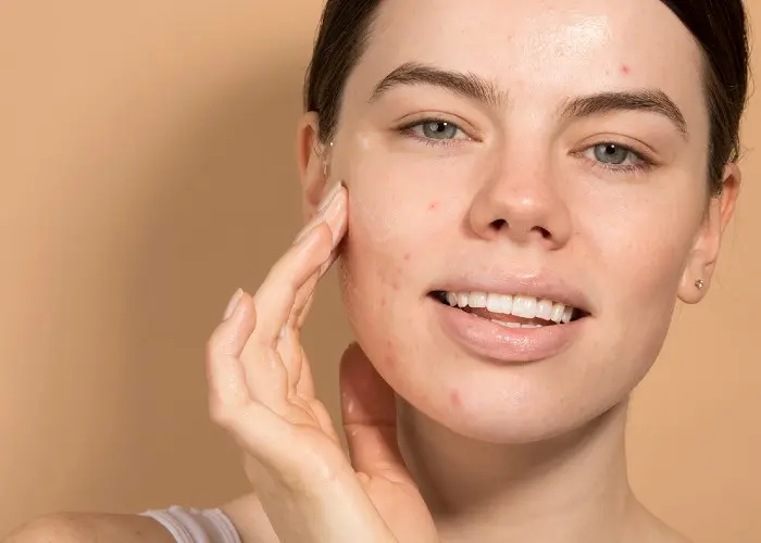The 10 Best Pimple Treatments