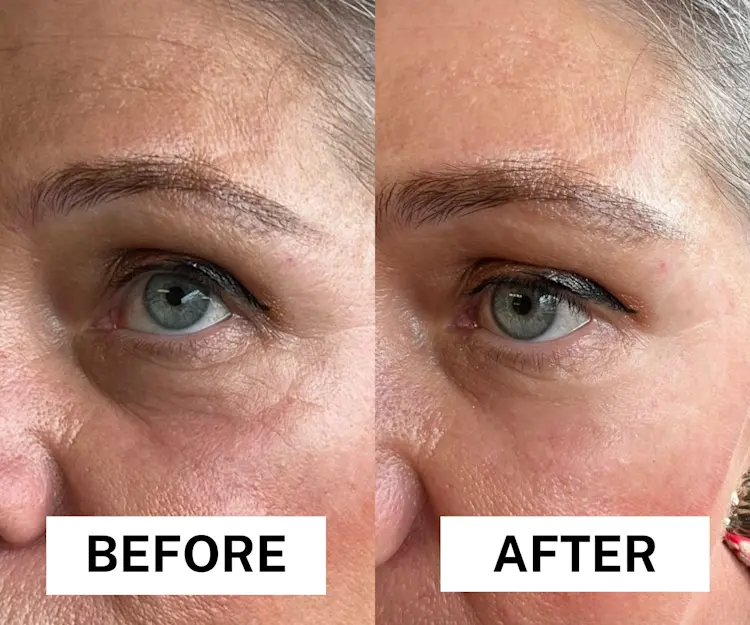 Before After