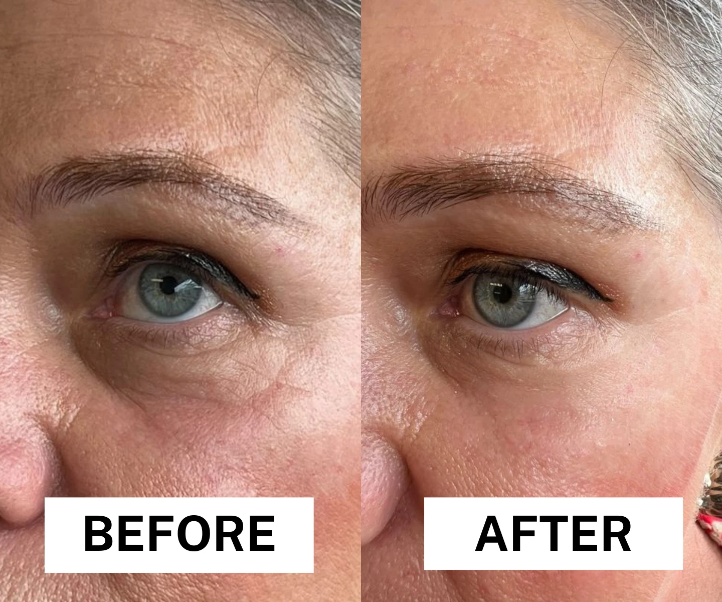 adore beauty article image