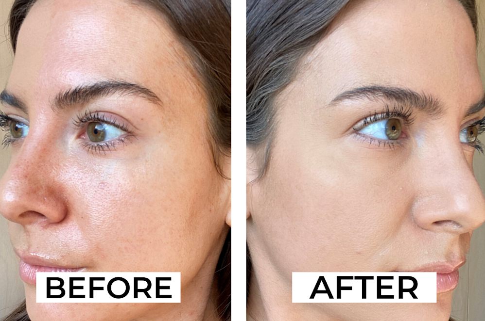 Makeup Artist Tips to Minimise Pores Instantly - Adore Beauty