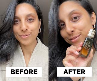 Estee Lauder Advanced Night Repair Eye Concentrate Matrix review before and after picture 