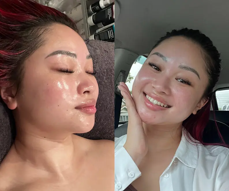 Exactly What Happened When I Got My First Ever Facial