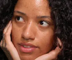 Beauty IQ Article - teen-acne-products