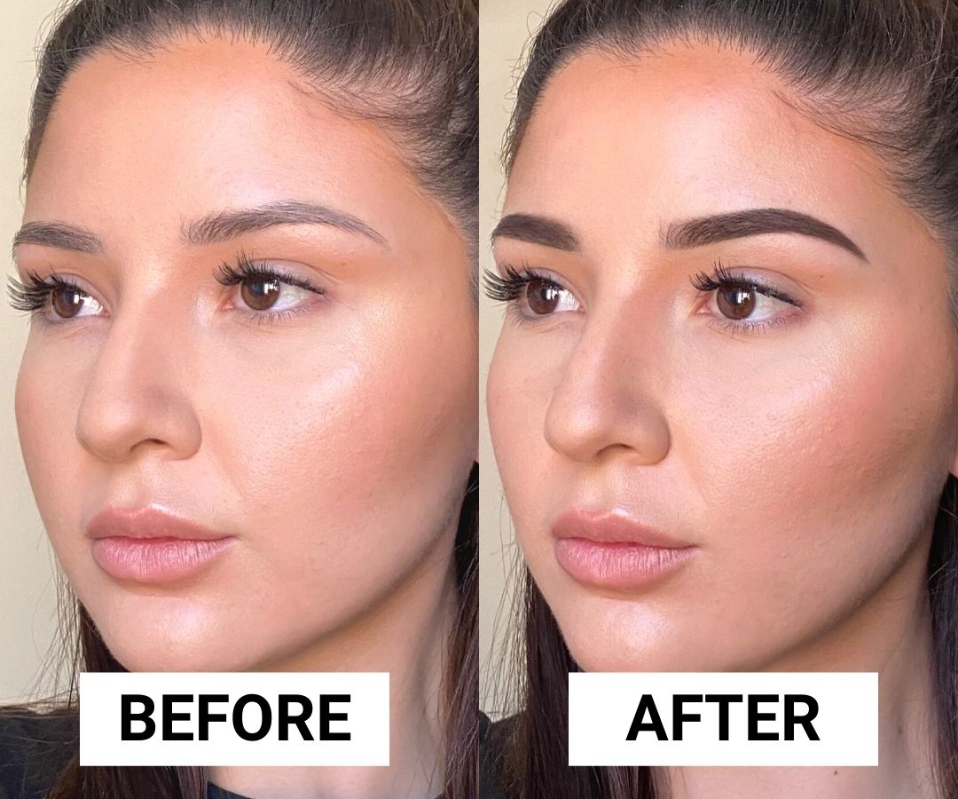 5 Epic \'Before Using the & After\' Products Beverly Transformations Best Hills Brow Anastasia